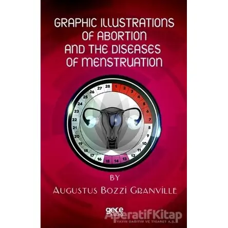 Graphic Illustrations Of Abortion And The Diseases Of Menstruation
