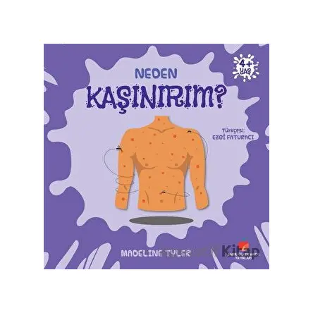 Neden Kaşınırım? - Madeline Tyler - Sabri Ülker Vakfı Yayınları
