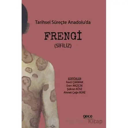 Tarihsel Süreçte Anadolu’da Frengi - Şükran Köse - Gece Kitaplığı