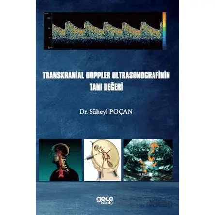 Transkranial Doppler Ultrasonografinin Tanı Değeri - Süheyl Poçan - Gece Kitaplığı
