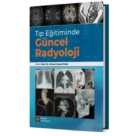 Tıp Eğitiminde Güncel Radyoloji - Ahmet Veysel Polat - İstanbul Tıp Kitabevi