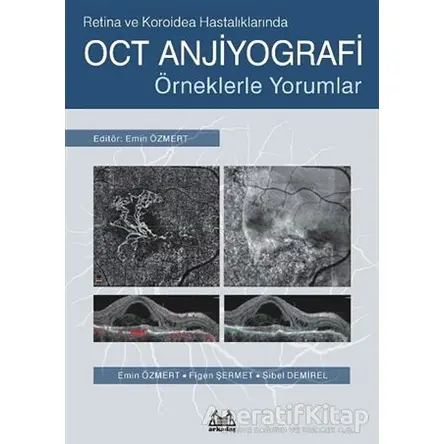 Retina ve Koroidea Hastalıklarında OCT Anjiyografi - Sibel Demirel - Arkadaş Yayınları