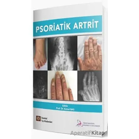 Psoriatik Artrit - Kemal Nas - İstanbul Tıp Kitabevi